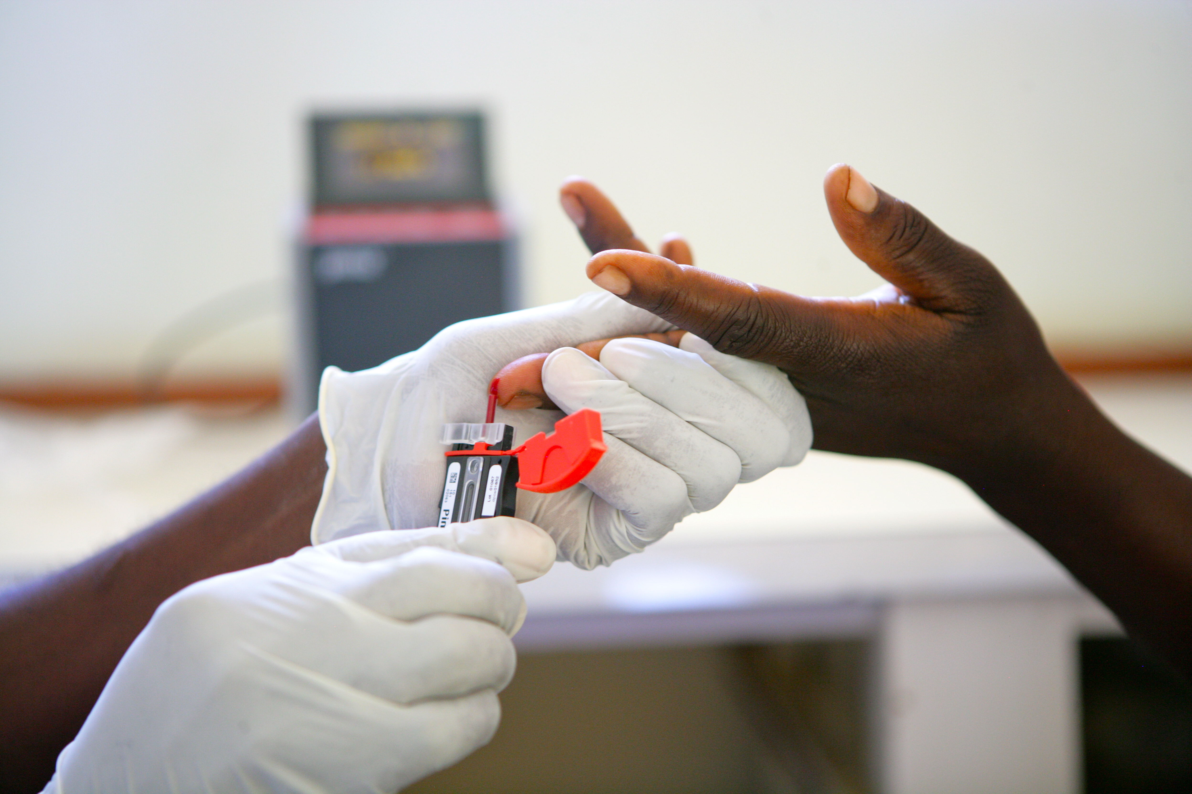 Image of collecting blood for HIV rapid test in Zimbabwe (©UNICEF/UNI106377/Pirozzi)